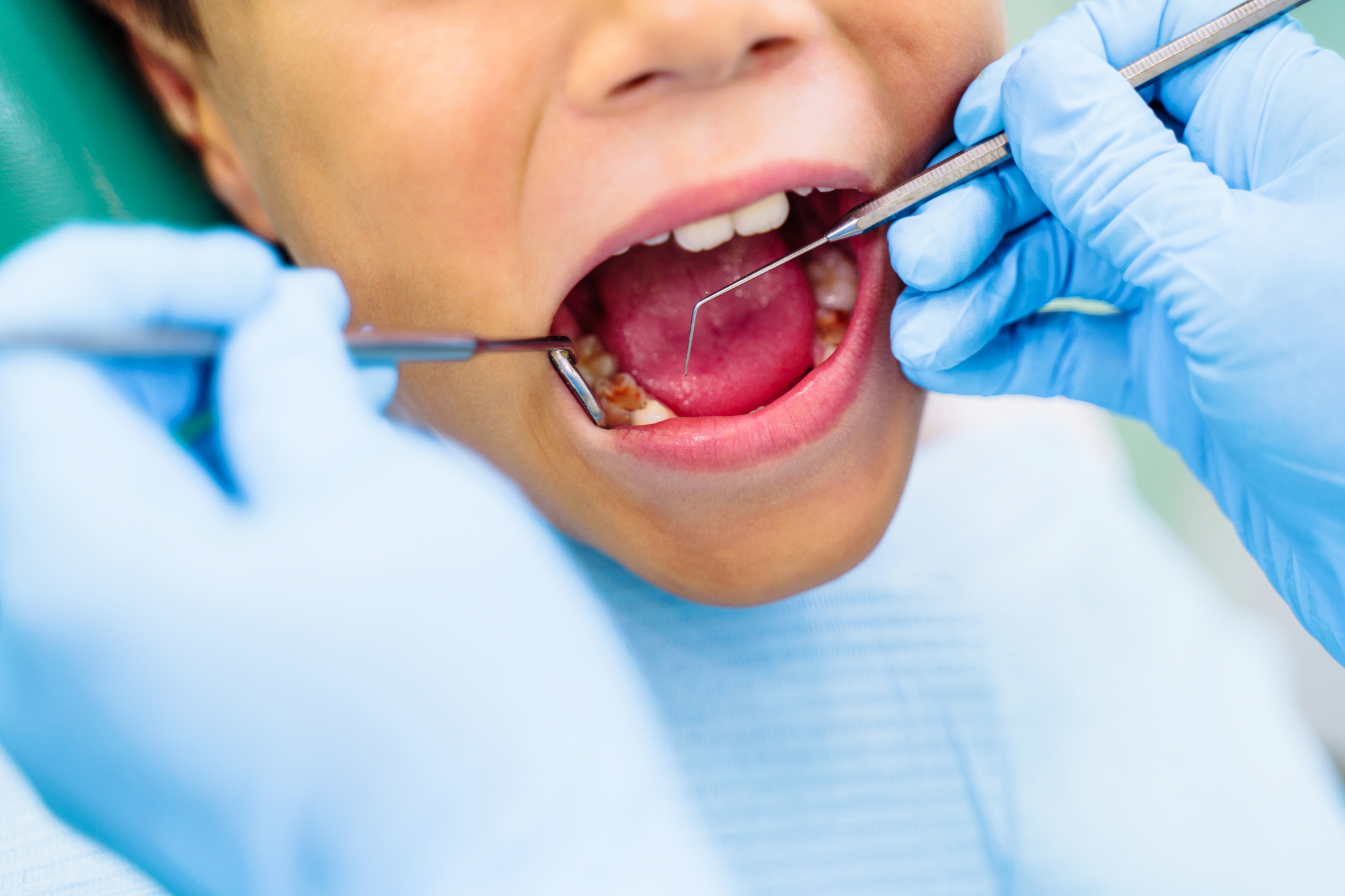 pediatric dental problems