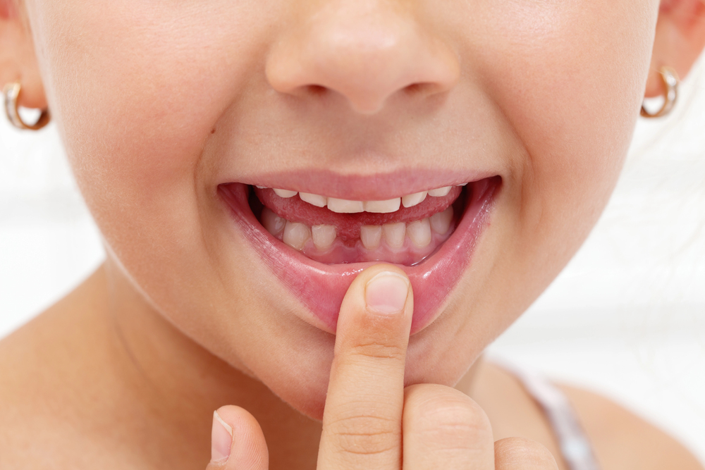 child dental development milestones